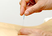 Acupuncture and Moxibustion